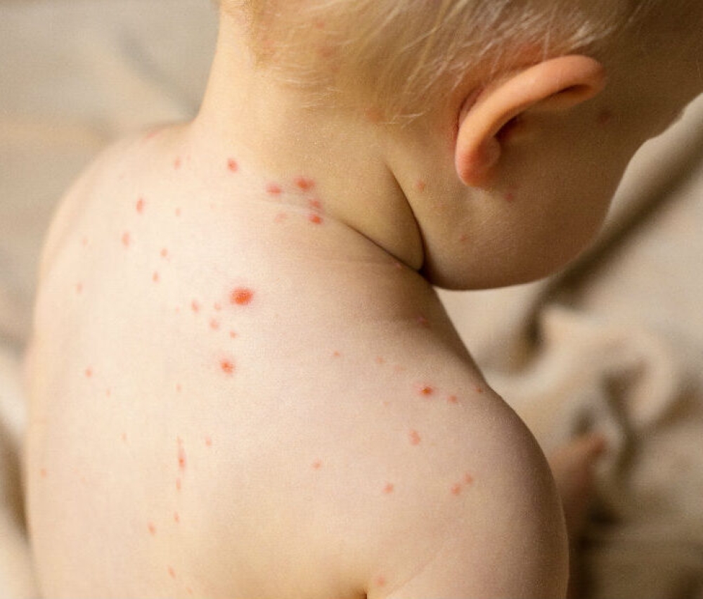 &laquo;&Sigma;&upsilon;&nu;&alpha;&gamma;&epsilon;&rho;&mu;ό&sigmaf;&raquo; &alpha;&pi;ό &tau;&eta;&nu; &alpha;&pi;ό&tau;&omicron;&mu;&eta; &alpha;ύ&xi;&eta;&sigma;&eta; &kappa;&rho;&omicron;&upsilon;&sigma;&mu;ά&tau;&omega;&nu; &iota;&lambda;&alpha;&rho;ά&sigmaf; &sigma;&tau;&eta;&nu; &Epsilon;&upsilon;&rho;ώ&pi;&eta;