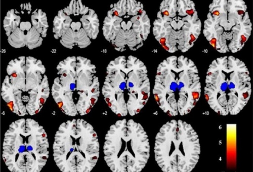 Εγκεφαλική περιοχή «προβλέπει» ό,τι κάτι κακό πρόκειται να συμβεί