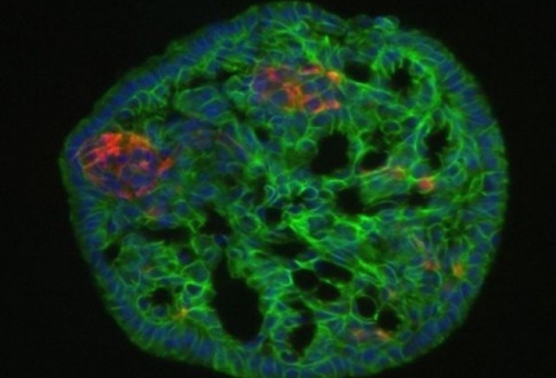 Μαζική παραγωγή β-κυττάρων παγκρέατος υπόσχεται ίαση του διαβήτη τύπου Ι