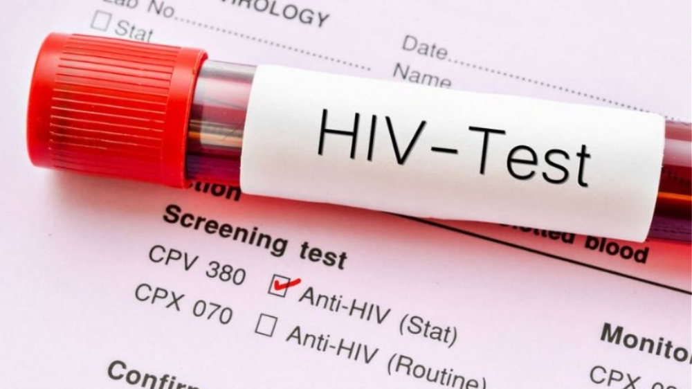 &Alpha;&nu;&alpha;&kappa;&alpha;&lambda;ύ&phi;&theta;&eta;&kappa;&epsilon; &sigma;&tau;&eta;&nu; &Epsilon;&upsilon;&rho;ώ&pi;&eta; &mu;ί&alpha; &nu;έ&alpha;, &pi;&iota;&omicron; &pi;&alpha;&theta;&omicron;&gamma;ό&nu;&alpha; &kappa;&alpha;&iota; &mu;&epsilon;&tau;&alpha;&delta;&omicron;&tau;&iota;&kappa;ή, &pi;&alpha;&rho;&alpha;&lambda;&lambda;&alpha;&gamma;ή &tau;&omicron;&upsilon; &iota;&omicron;ύ HIV