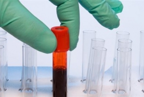 Εξέταση αίματος προβλέπει το απόθεμα ωαρίων κάθε γυναίκας