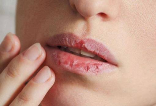 5 πράγματα που σου λένε τα χείλη για την υγεία σου