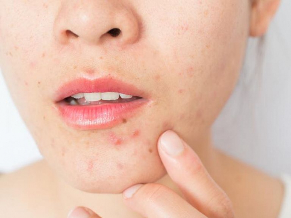 3 &beta;&alpha;&sigma;&iota;&kappa;ά &pi;&rho;ά&gamma;&mu;&alpha;&tau;&alpha; &pi;&omicron;&upsilon; &delta;&epsilon;&nu; &xi;έ&rho;&epsilon;&iota;&sigmaf; &gamma;&iota;&alpha; &tau;&alpha; &sigma;&pi;&upsilon;&rho;ά&kappa;&iota;&alpha; &sigma;&omicron;&upsilon;