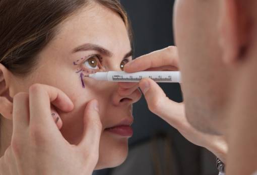 Βλεφαροπλαστική: Η ανώδυνη επέμβαση που ανανεώνει το βλέμμα και την αυτοπεποίθηση