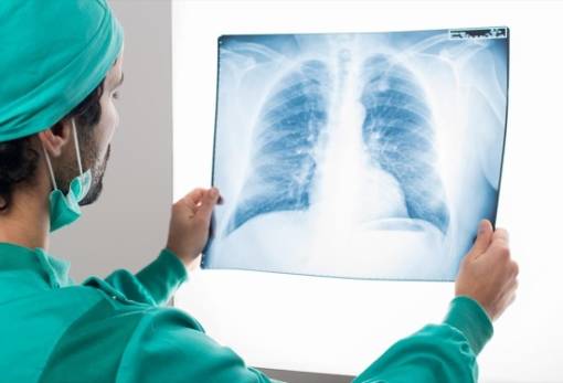 Νέα έρευνα «ελπίδα» για τον καρκίνο του πνεύμονα