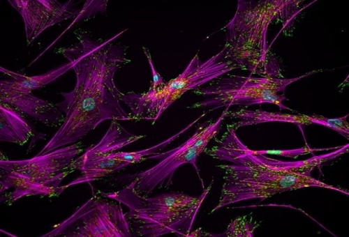 Επαναφορά ανθρώπινων βλαστικών κυττάρων στην αρχέγονη κατάστασή τους