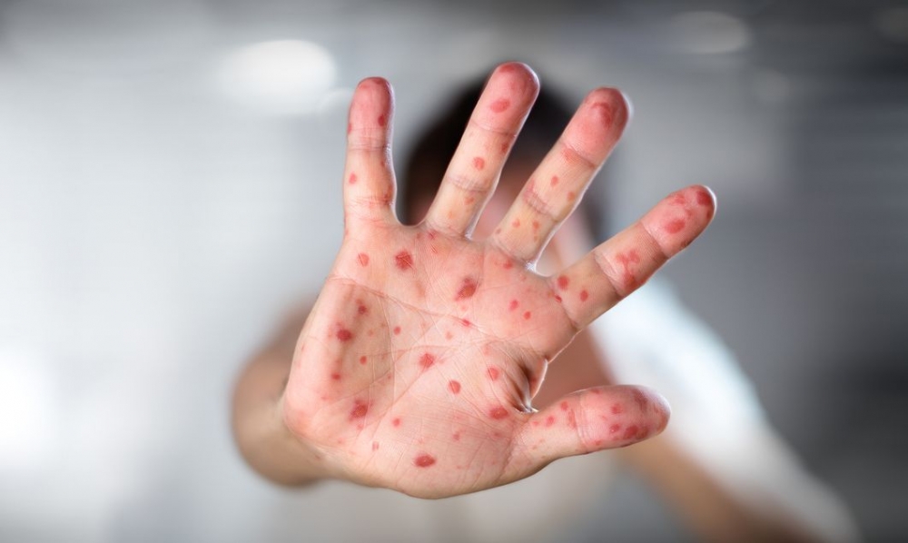 &Pi;&rho;&omicron;&epsilon;&iota;&delta;&omicron;&pi;&omicron;ί&eta;&sigma;&eta; &Pi;&omicron;&upsilon; &gamma;&iota;&alpha; &epsilon;&pi;&iota;&kappa;&epsilon;ί&mu;&epsilon;&nu;&eta; έ&xi;&alpha;&rho;&sigma;&eta; &kappa;&rho;&omicron;&upsilon;&sigma;&mu;ά&tau;&omega;&nu; &Iota;&lambda;&alpha;&rho;ά&sigmaf;