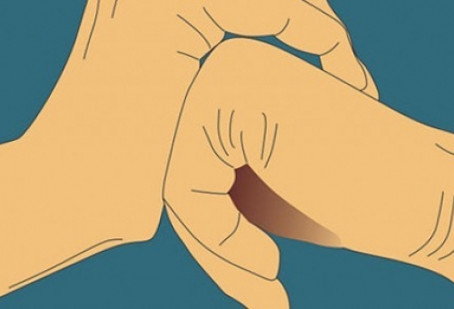 Γιατί δεν πρέπει να «τρίζετε» τα δάχτυλά σας