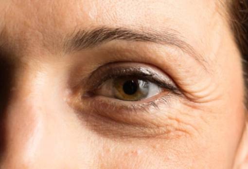 Βλέμμα Νεότητας: 5 τρόποι να μειώσεις τις λεπτές γραμμές