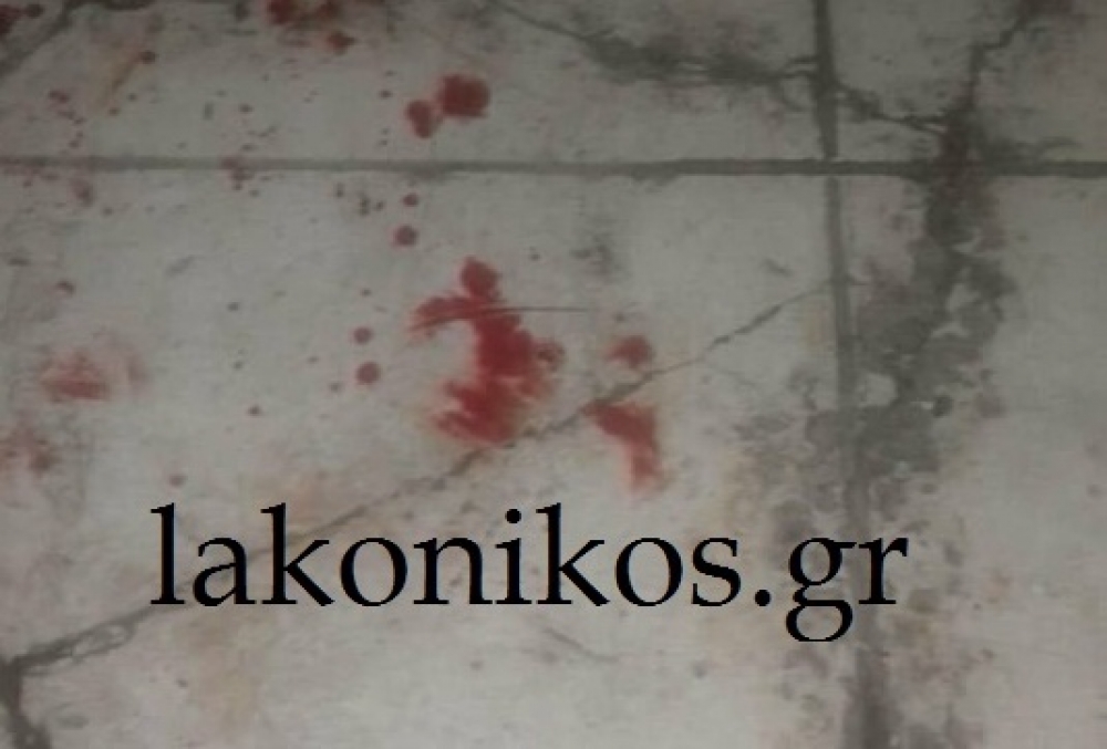 &Sigma;&upsilon;&gamma;&kappa;&lambda;&omicron;&nu;ί&zeta;&omicron;&upsilon;&nu; &omicron;&iota; &lambda;&epsilon;&pi;&tau;&omicron;&mu;έ&rho;&epsilon;&iota;&epsilon;&sigmaf; &tau;&omicron;&upsilon; &epsilon;&gamma;&kappa;&lambda;ή&mu;&alpha;&tau;&omicron;&sigmaf; &mu;&epsilon; &theta;ύ&mu;&alpha; &tau;&omicron;&nu; &Gamma;. &Alpha;&rho;&phi;ά&nu;&eta;