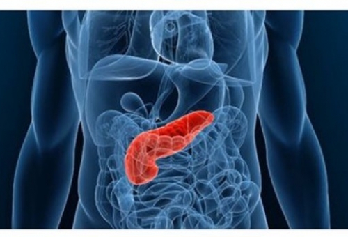 Νέος βιοδείκτης υπόσχεται έγκαιρη διάγνωση του καρκίνου του παγκρέατος