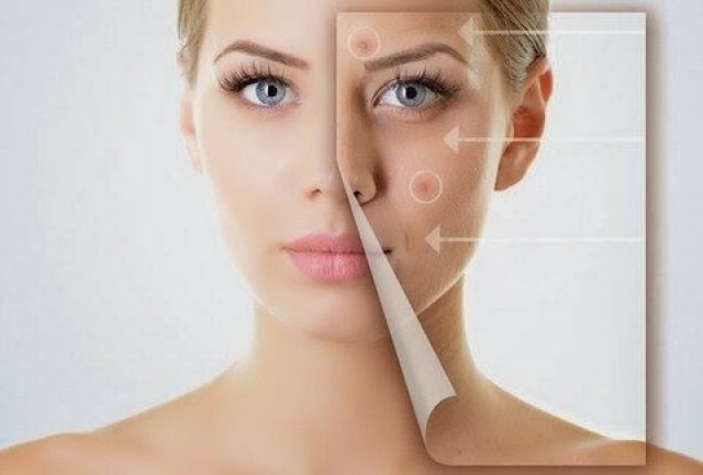 &Sigma;&pi;&iota;&tau;&iota;&kappa;έ&sigmaf; &theta;&epsilon;&rho;&alpha;&pi;&epsilon;ί&epsilon;&sigmaf; &gamma;&iota;&alpha; &phi;&rho;&alpha;&gamma;&mu;έ&nu;&omicron;&upsilon;&sigmaf; &pi;ό&rho;&omicron;&upsilon;&sigmaf;