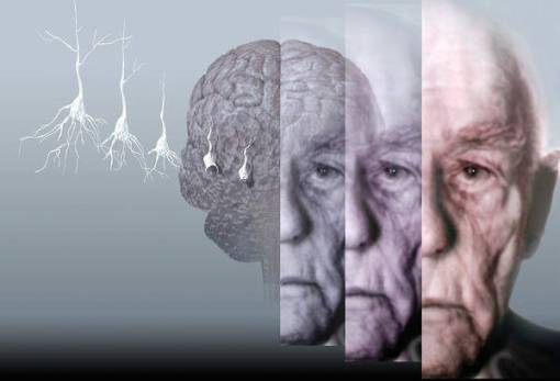 Γιατί αυτοκτονούν τα εγκεφαλικά κύτταρα στην νόσο Αλτσχάιμερ;