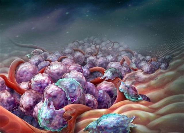 &Pi;&epsilon;&iota;&rho;&alpha;&mu;&alpha;&tau;&iota;&kappa;ή &theta;&epsilon;&rho;&alpha;&pi;&epsilon;ί&alpha; &laquo;&phi;&rho;&epsilon;&nu;ά&rho;&epsilon;&iota;&raquo; &tau;&eta; &mu;&epsilon;&tau;ά&sigma;&tau;&alpha;&sigma;&eta; &tau;&omicron;&upsilon; &kappa;&alpha;&rho;&kappa;ί&nu;&omicron;&upsilon;