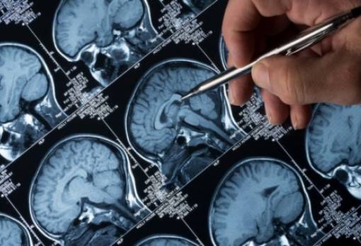 Ποιες οδηγικές συνήθειες μπορούν να αποκαλύψουν πρώιμα συμπτώματα της νόσου Αλτσχάιμερ