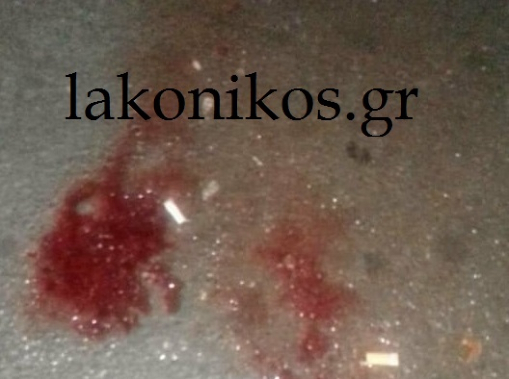 Ά&gamma;&rho;&iota;&alpha; &delta;&omicron;&lambda;&omicron;&phi;&omicron;&nu;ί&alpha; &Sigma;&pi;&alpha;&rho;&tau;&iota;ά&tau;&eta; έ&xi;&omega; &alpha;&pi;ό &epsilon;&lambda;&lambda;&eta;&nu;ά&delta;&iota;&kappa;&omicron; &tau;&alpha; &xi;&eta;&mu;&epsilon;&rho;ώ&mu;&alpha;&tau;&alpha; &sigma;&tau;&eta; &Sigma;&pi;ά&rho;&tau;&eta;! (&Phi;&Omega;&Tau;&Omicron;)